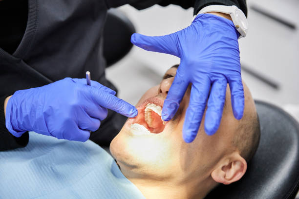 Best Emergency Tooth Extraction in Dunkirk, NY